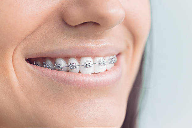 Best Traditional Braces  in Helena West Helena, AR